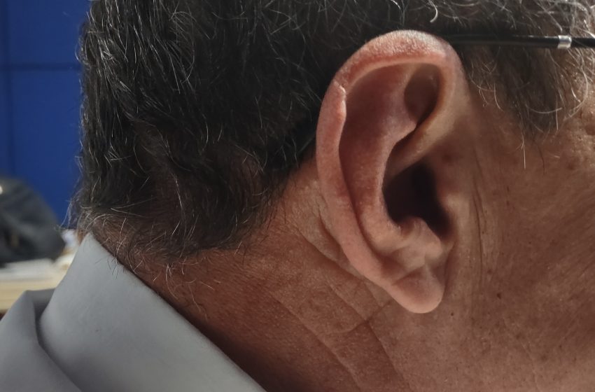  Frio é responsável pelo aumento de 70 por cento de casos de otite média – especialista explica como prevenir as chamadas infecções no ouvido