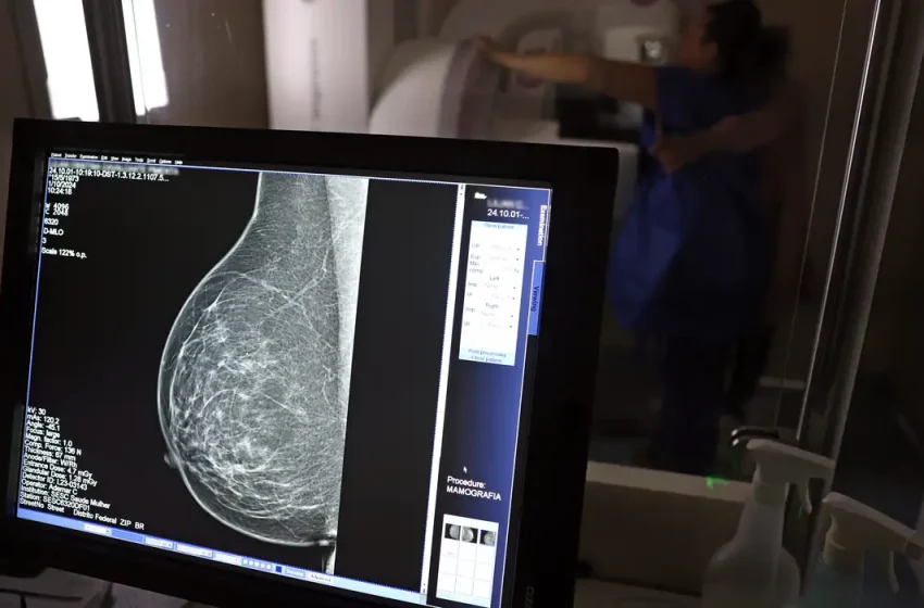  Ministério da Saúde passa a recomendar mamografia a partir dos 40 anos